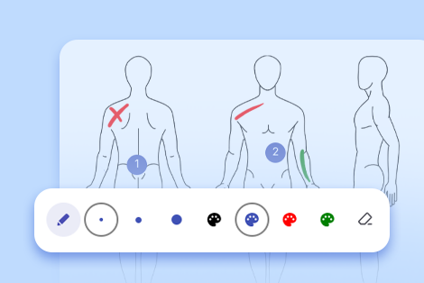 Illustration of a human anatomy body chart with a toolbar of sketching tools for documenting treatment notes