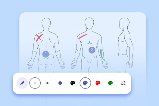 Screenshot of an intuitive online charting tool showing a body diagram with marked areas and an overlaying toolbar for notes and annotations.