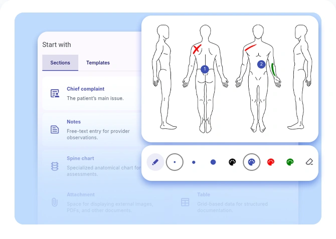 Chart note screen with body chart overlay and toolbar for clinical annotations